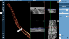 Tomografischer Ultraschall - Online Kurse
